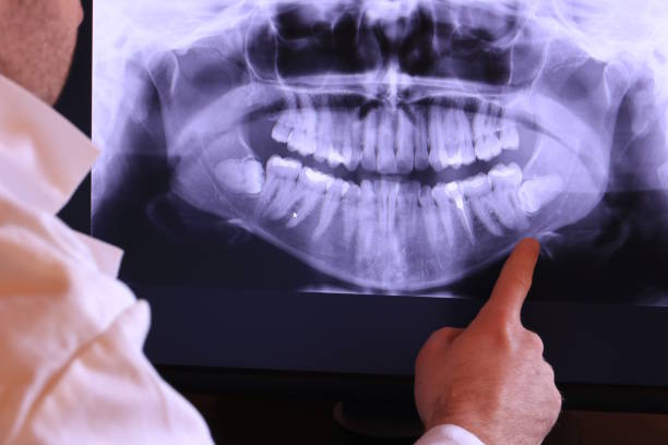 Best Emergency Dentist for Knocked-Out Tooth in Bainbridge, PA